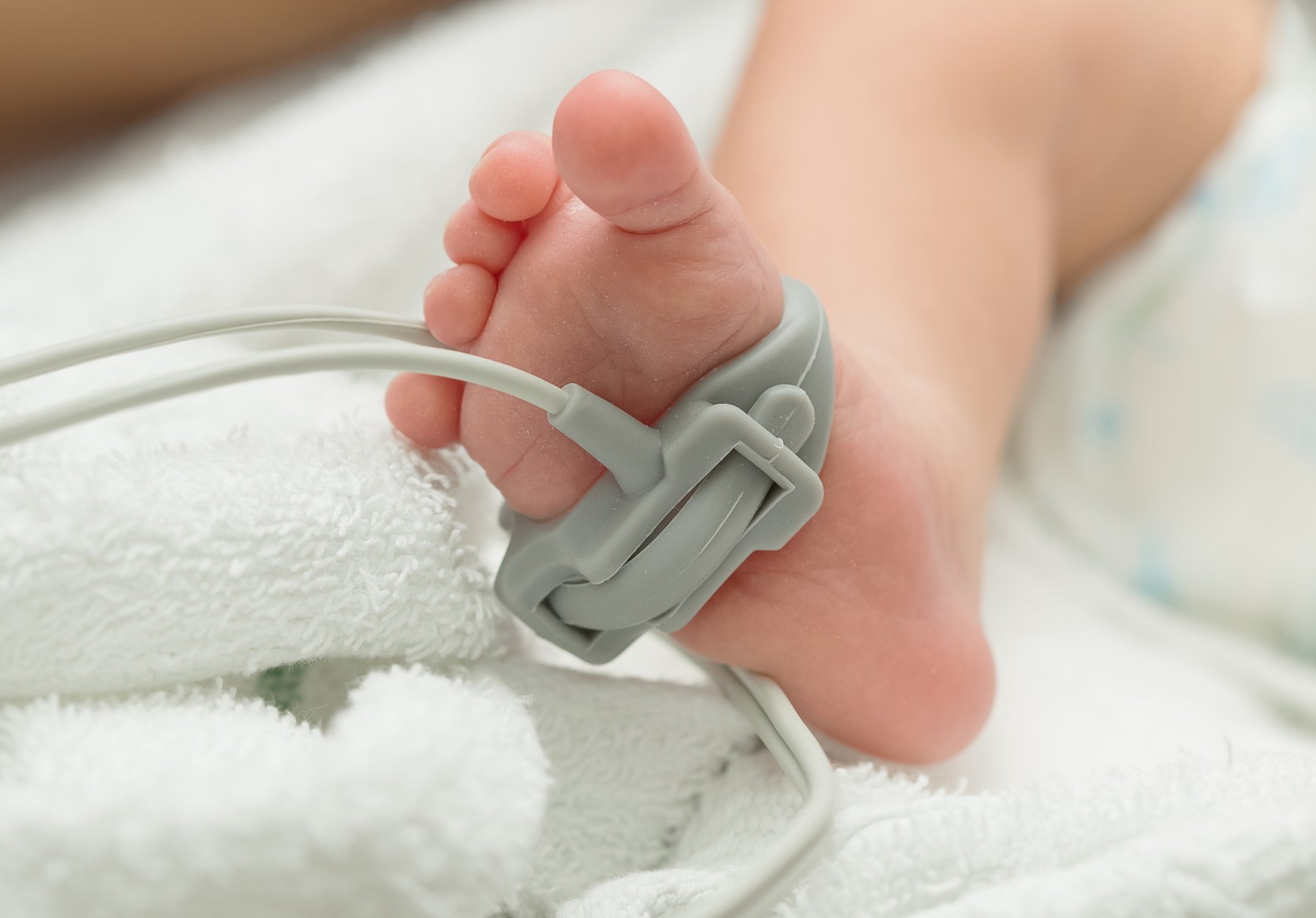 Medizinischer Klebstoff Dymax 2101-MW-UR zur Verwendung in intelligenten tragbaren medizinischen Produkten wie Pulsoximetern für Säuglinge